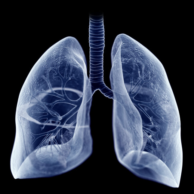 COPD Photo